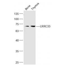 Anti-LRRC33 antibody