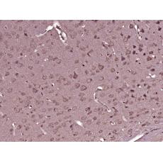 Anti-LTBR antibody