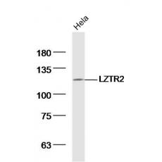 Anti-LZTR2 antibody