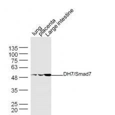 Anti-MADH7/Smad7 antibody