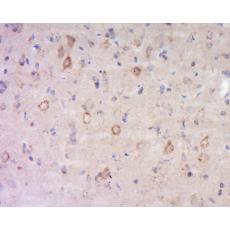 Anti-MAG antibody