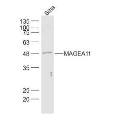 Anti-MAGEA11 antibody