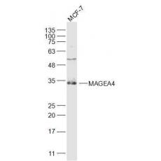 Anti-MAGEA4 antibody