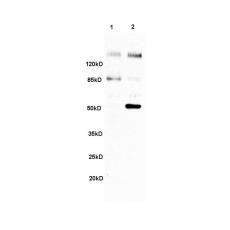 Anti-MAP3K8 antibody