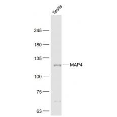 Anti-MAP4 antibody