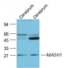 Anti-MASH1 antibody