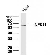 Anti-NEK11 antibody