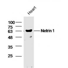 Anti-Netrin 1 antibody