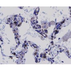 Anti-NF-κB p65 antibody