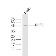 Anti-NLE1 antibody