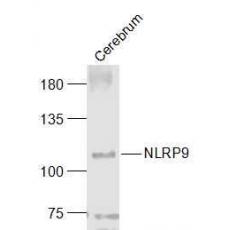 Anti-NLRP9 antibody