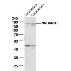 Anti-NMDAR2C antibody
