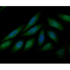 Anti-LOXL2 antibody