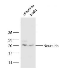 Anti-Neurturin antibody