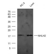 Anti-NHLH2 antibody