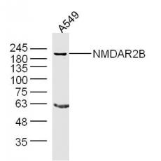 Anti-NMDAR2B antibody