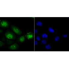 Anti-Nfic antibody