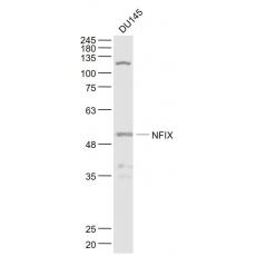 Anti-NFIX antibody