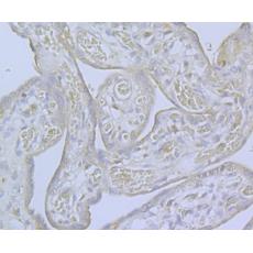 Anti-CaV2.3 antibody