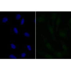 Anti-NIPSNAP1 antibody