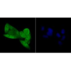 Anti-CDKN2A/p16INK4a antibody