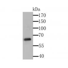 Anti-USP14 antibody