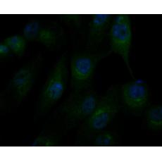 Anti-alpha Actinin antibody
