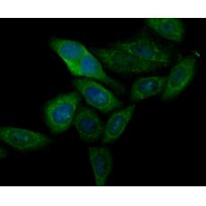 Anti-CASK antibody