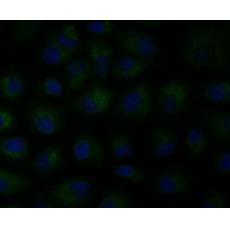 Anti-MCU antibody