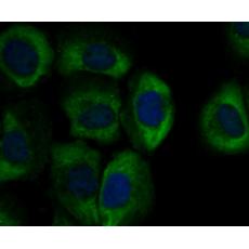Anti-SCNN1G antibody