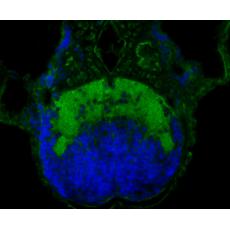 Anti-FNDC3A antibody