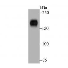 Anti-Nephrin antibody