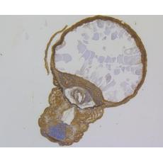 Anti-GTSF1 antibody