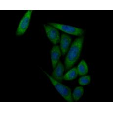 Anti-Prolactin/PRL antibody