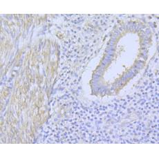 Anti-CACNA1C antibody