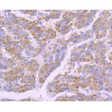 Anti-SDHB antibody