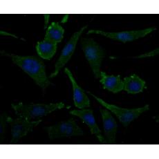 Anti-ACY-1 antibody