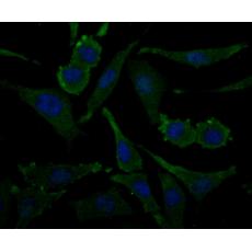 Anti-ACY-1 antibody