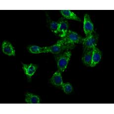 Anti-CD99 antibody