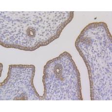 Anti-Cytokeratin 7 antibody