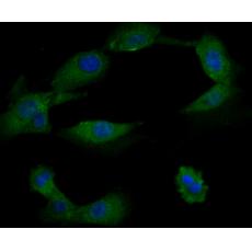 Anti-TRPA1 antibody