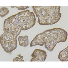 Anti-RYR3 antibody