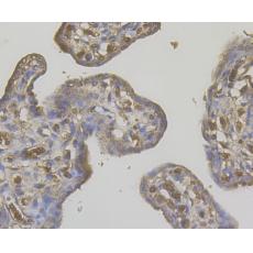 Anti-STIM2 antibody
