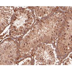 Anti-delta 1 Catenin/CAS antibody