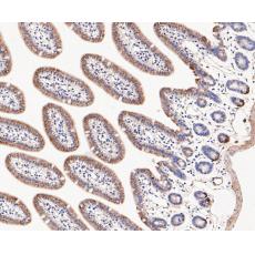 Anti-DFNA5/GSDME antibody