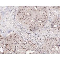 Anti-SSRP1 antibody