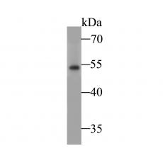 Anti-NPY2R / Y2 receptor antibody