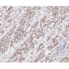 Anti-SSB antibody