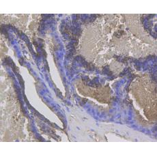 Anti-Cytokeratin 17 antibody
