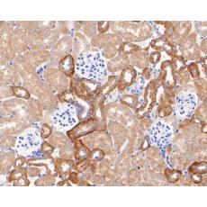 Anti-Kir5.1 antibody